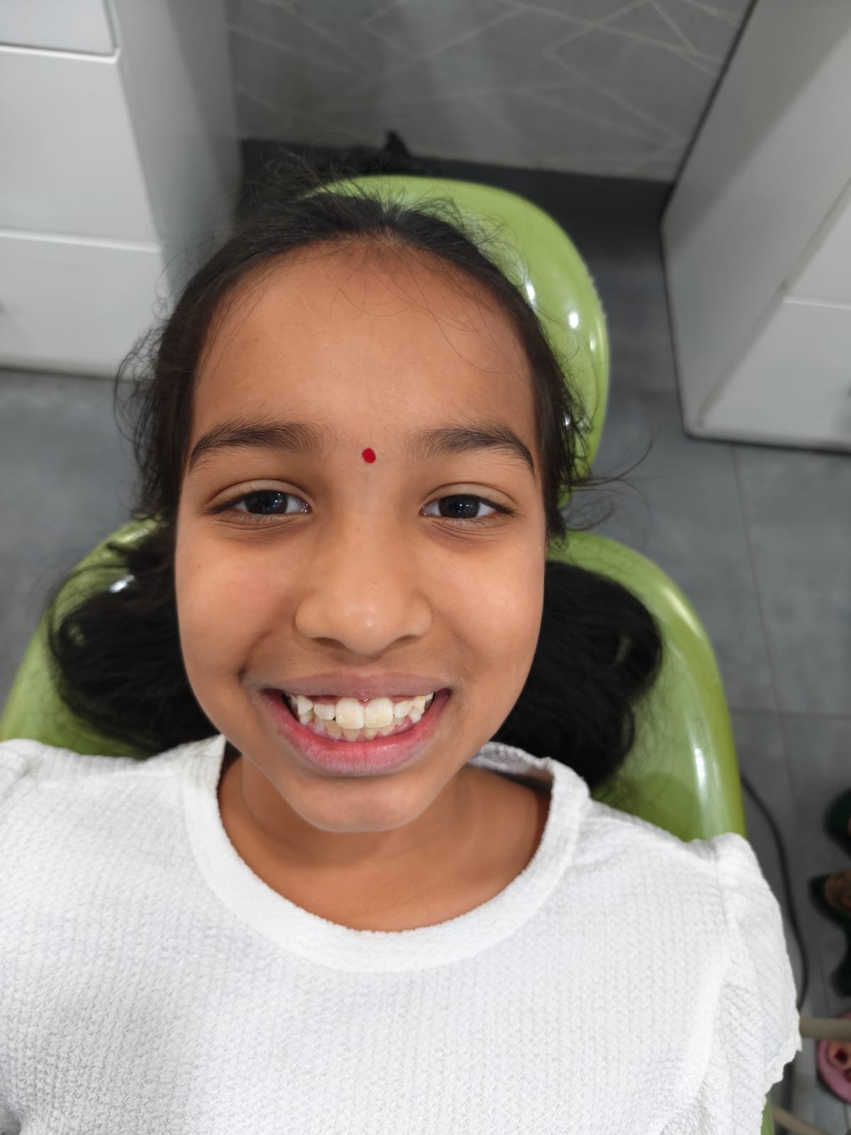 Young Patient — Post Treatment Smile at Sri Ramachandra Dental Hospital