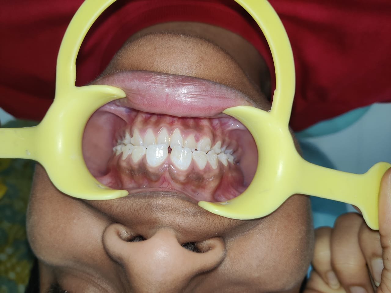 Orthodontic Assessment at Sri Ramachandra Dental Hospital