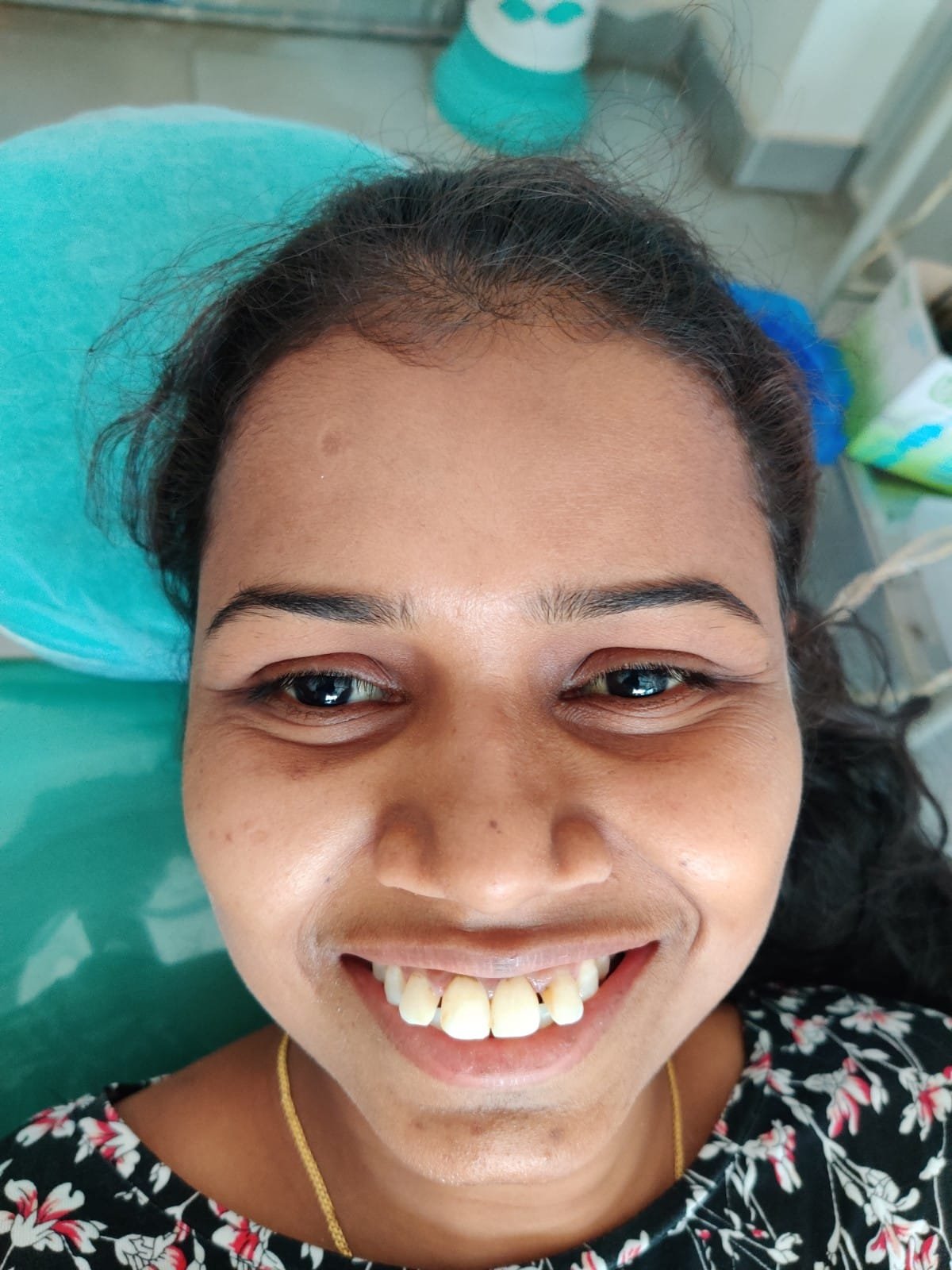 Confident Smile Restored at Sri Ramachandra Dental Hospital