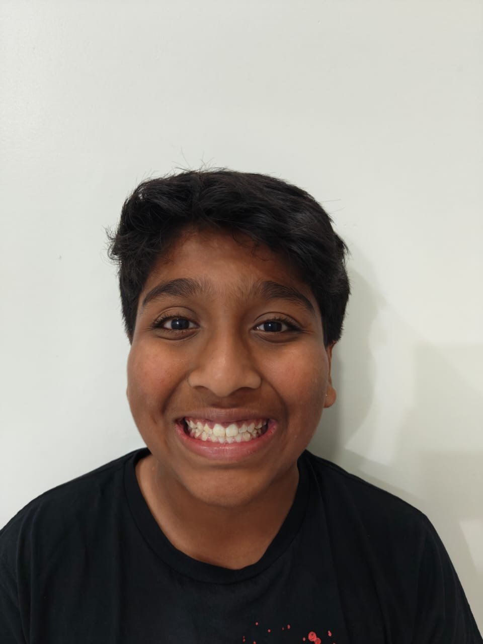 Teenager — Happy Smile at Sri Ramachandra Dental Hospital