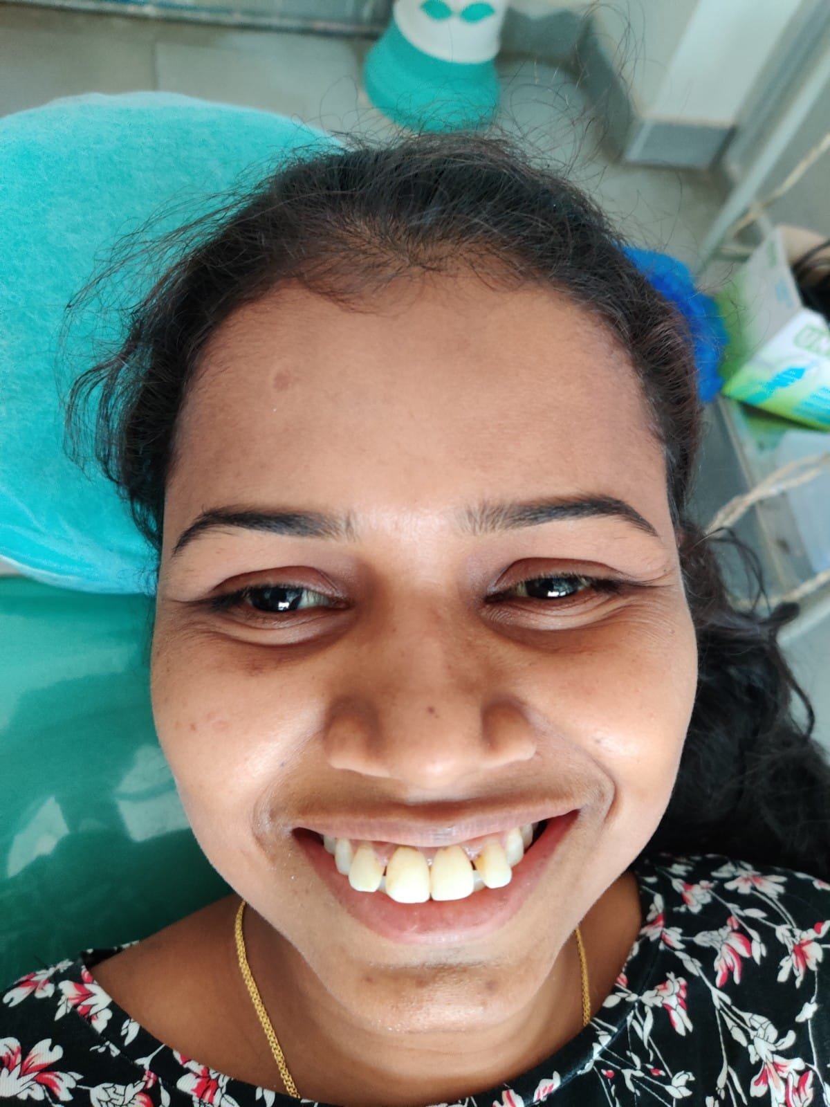 Patient Recovery — Beautiful Smile at Sri Ramachandra Dental Hospital