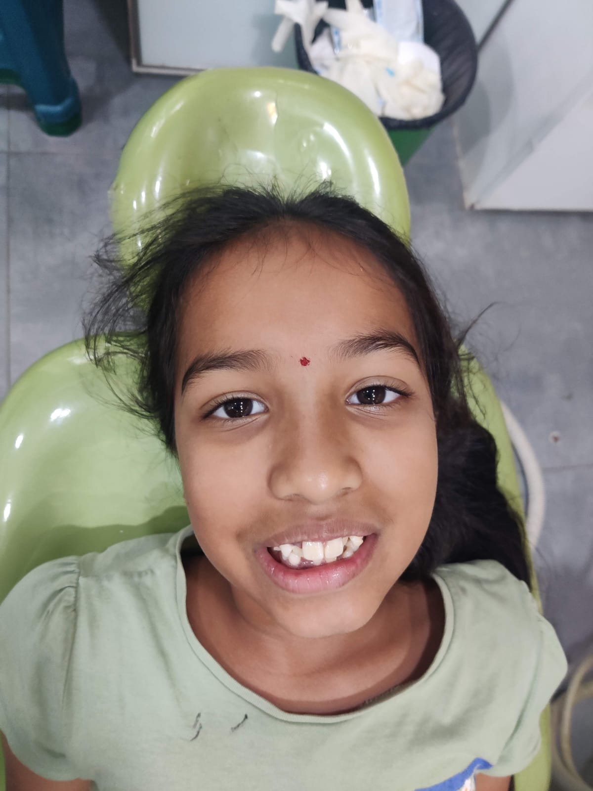 Child — Smiling After Treatment at Sri Ramachandra Dental Hospital